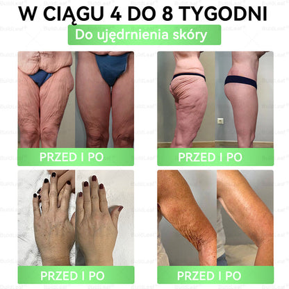 BuildLeaf® 💧 GLP-1 8-w-1 Fit & Vital Rozwiązanie(Jednorazowe dziennie, widoczne zmiany w ciągu 7 dni)